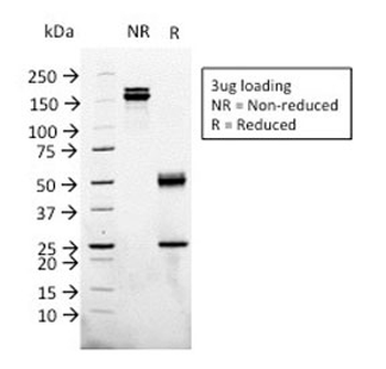 Glypican 3 Antibody / GPC3