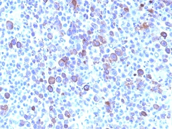 Glypican 3 Antibody / GPC3