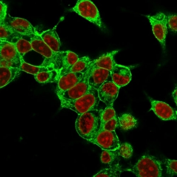 Glypican 3 Antibody / GPC3