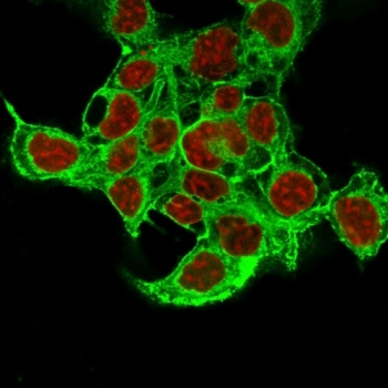 Glypican-3 Antibody Cocktail
