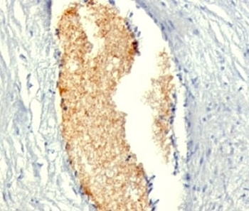 AMPD3 Antibody