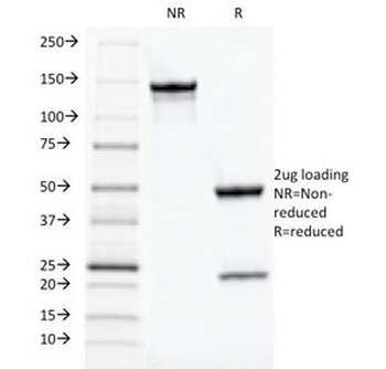 TOX3 Antibody