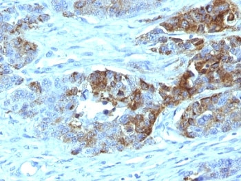 ABO Antibody / Blood Group Antigen H Type 2
