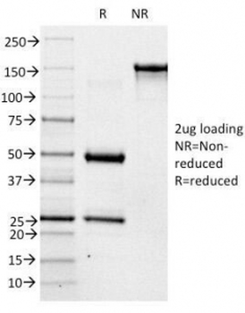 ABO Antibody (Blood Group Antigen A)
