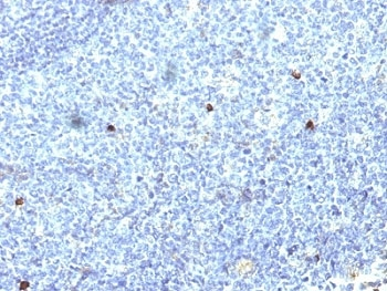 HLA-A25 Antibody (HLA-Aw32)
