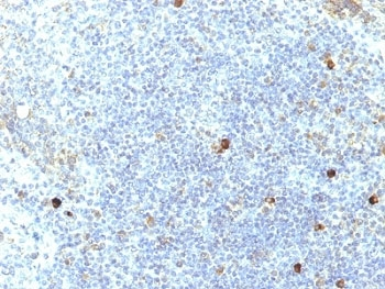 HLA-A25 Antibody (HLA-Aw32)