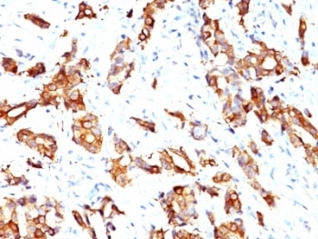 HSP27 Antibody / HSPB1