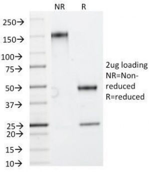 HSP27 Antibody / HSPB1