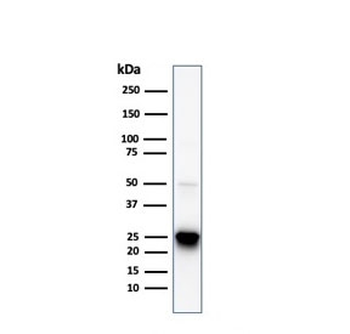 HSP27 Antibody / HSPB1
