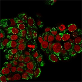 HSP60 Antibody