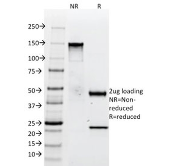 Tenascin C Antibody
