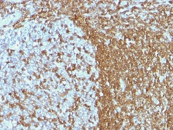 ICAM-3 Antibody / CD50