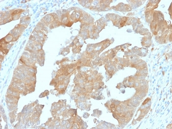 IDH1 Antibody / Isocitrate Dehydrogenase