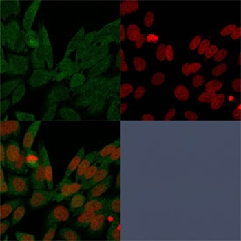 IDH1 Antibody / Isocitrate Dehydrogenase