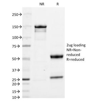 IgA Heavy Chain Antibody