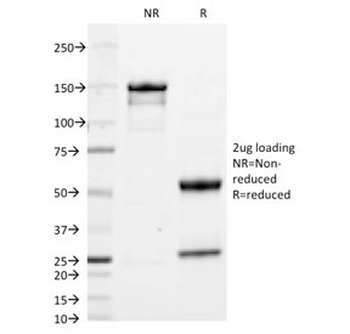 IgA Antibody