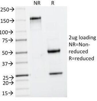 Insulin Antibody