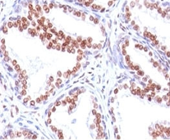 Androgen Receptor Antibody