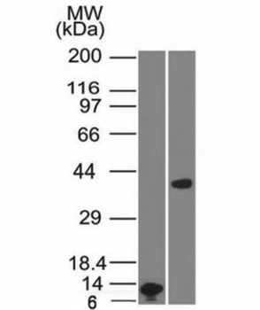 Arginase 1 Antibody