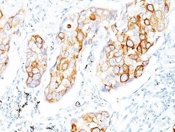 KRT7 Antibody / Cytokeratin 7