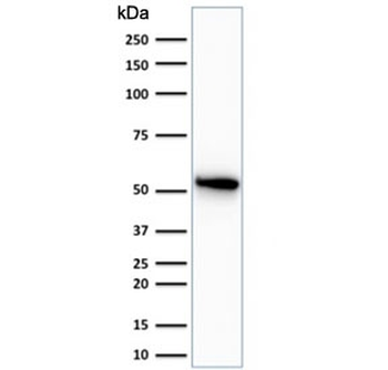 KRT7 Antibody / Cytokeratin 7