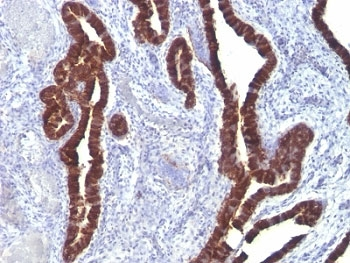 KRT7 Antibody / Cytokeratin 7