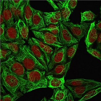 KRT7 Antibody / Cytokeratin 7
