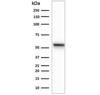 KRT7 Antibody / Cytokeratin 7