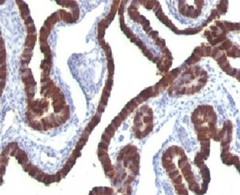 KRT7 Antibody / Cytokeratin 7