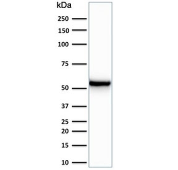 KRT7 Antibody / Cytokeratin 7
