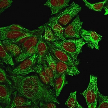 KRT7 Antibody / Cytokeratin 7