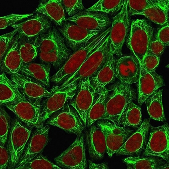 KRT7 Antibody Cocktail / Cytokeratin 7
