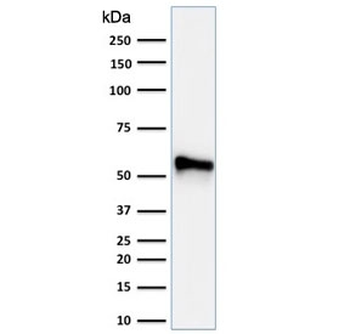 KRT7 Antibody Cocktail / Cytokeratin 7