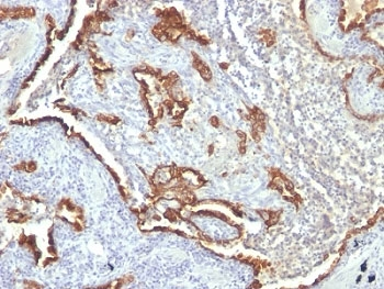 KRT7 Antibody Cocktail / Cytokeratin 7