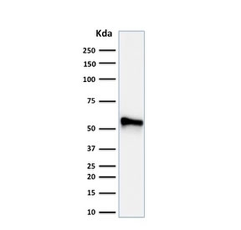 KRT7 Antibody Cocktail / Cytokeratin 7
