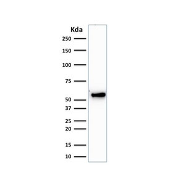 KRT7 Antibody / Cytokeratin 7