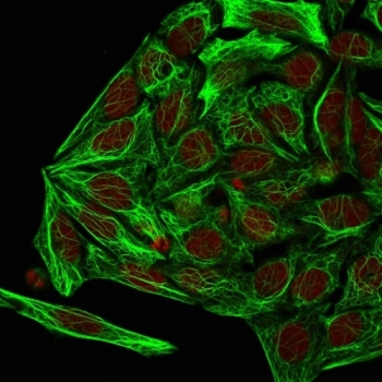 KRT7 Antibody / Cytokeratin 7