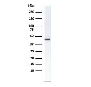 KRT8 Antibody / Cytokeratin 8