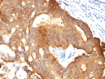 KRT8 Antibody / Cytokeratin 8