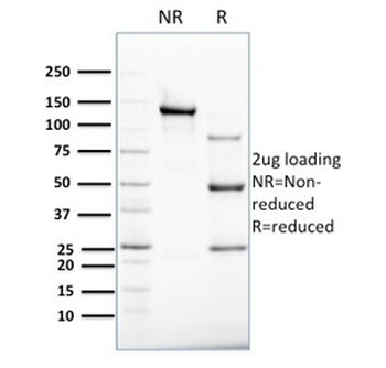 KRT8 Antibody / Cytokeratin 8