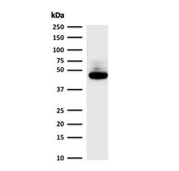KRT8 Antibody / Cytokeratin 8