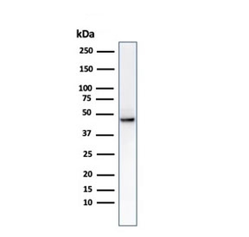 KRT8 Antibody / Cytokeratin 8