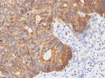 KRT8 Antibody / Cytokeratin 8