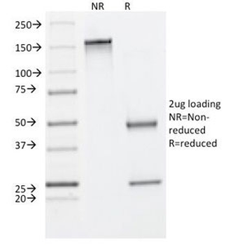 KRT8 Antibody / Cytokeratin 8