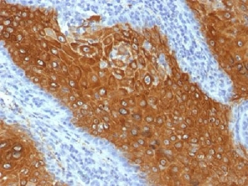 KRT10 Antibody / Cytokeratin 10