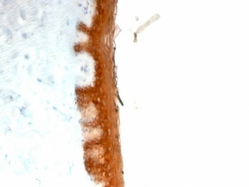 KRT10 Antibody / Cytokeratin 10
