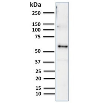 KRT10 Antibody / Cytokeratin 10