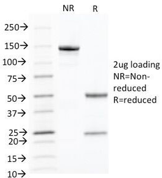 KRT10 Antibody / Cytokeratin 10
