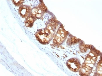 Cytokeratin 18 Antibody
