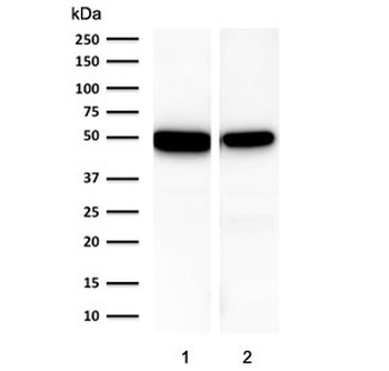 Cytokeratin 18 Antibody